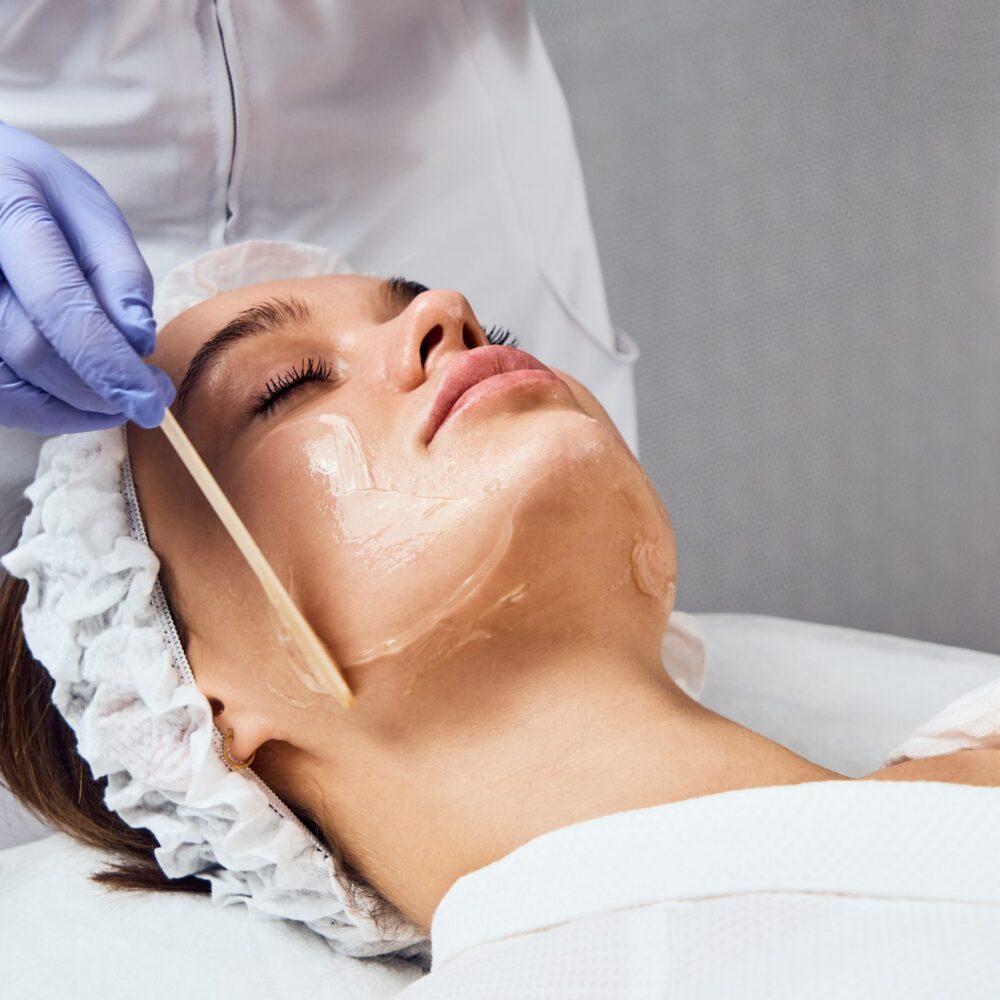 Chemical Peels