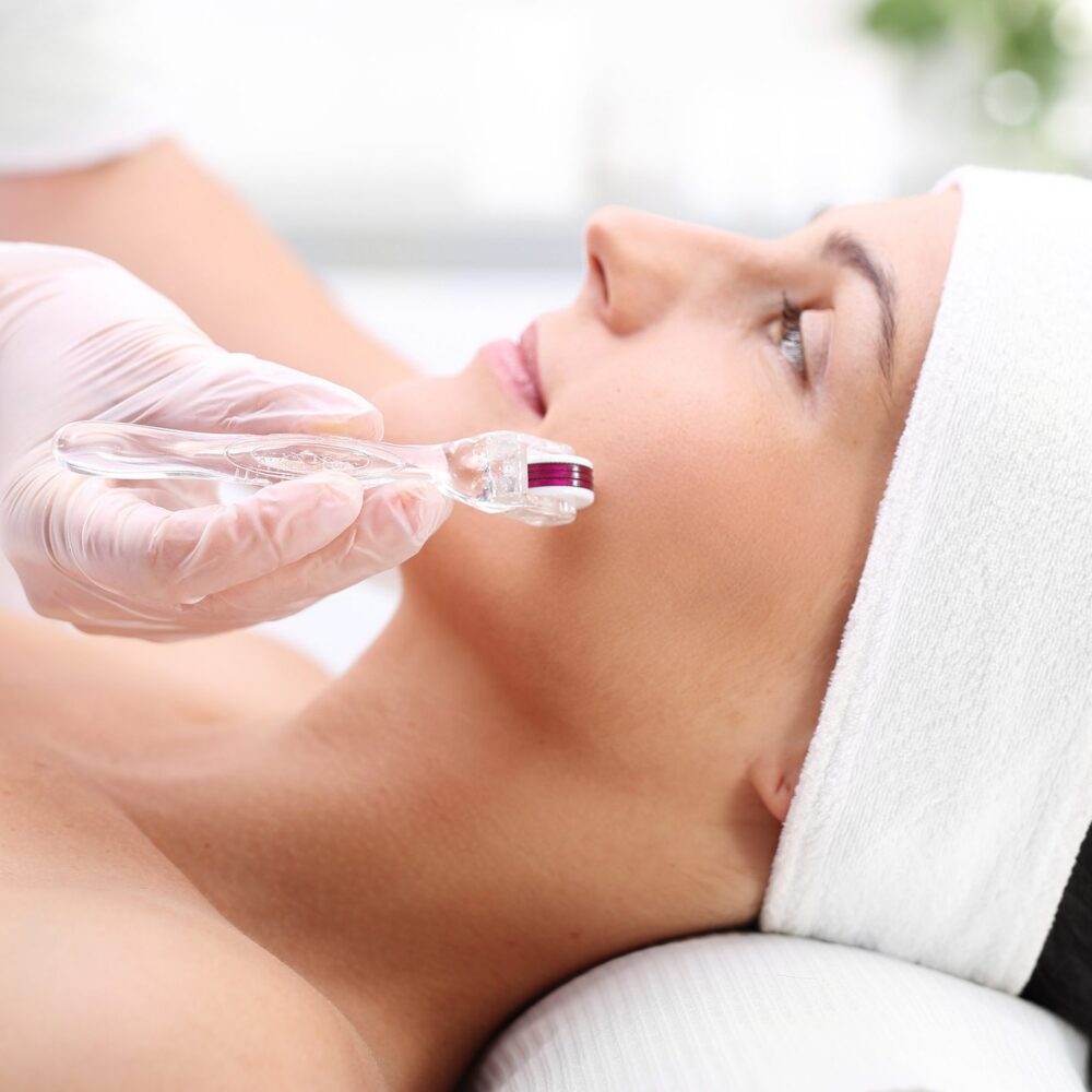 Microchanneling