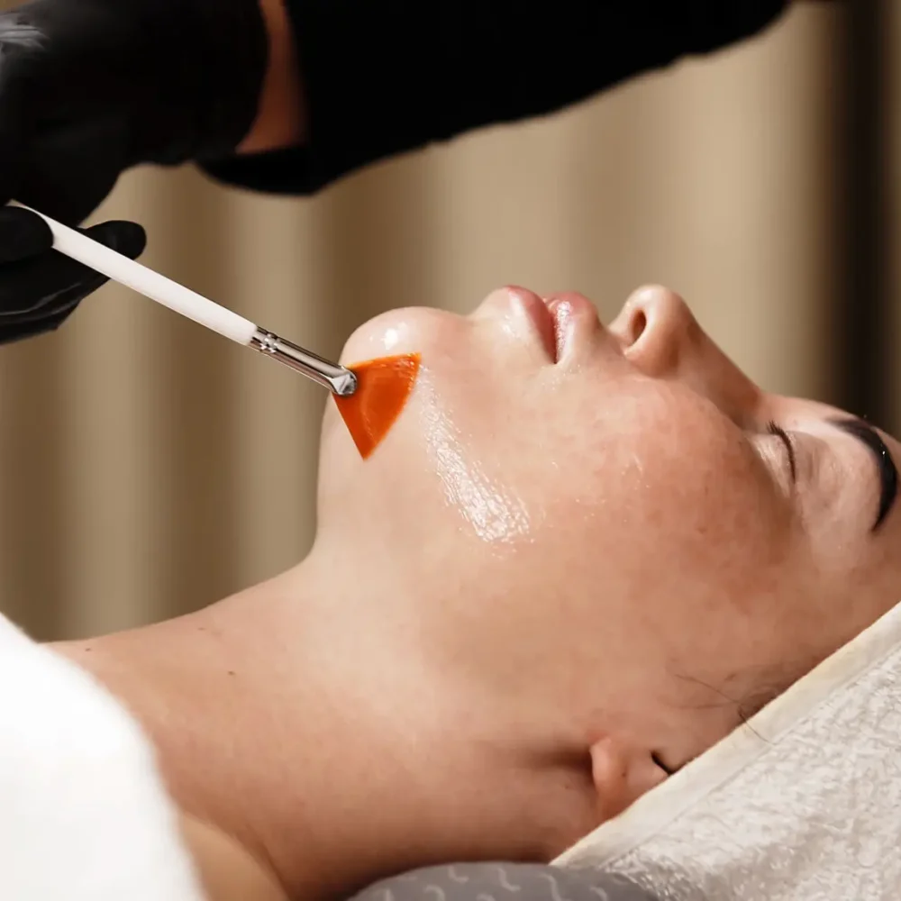 Radiance C Facial